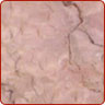 granites